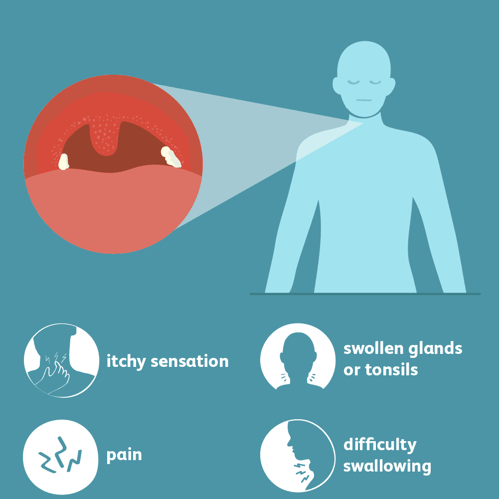 Sore Throat Signs Symptoms And Complications intended for size 1001 X 1001